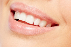 Blanchiment et facettes Explications par votre centre dentaire Longjumeau