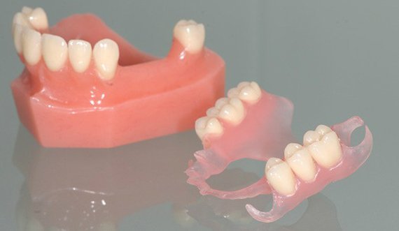 Prothèses dentaires et couronnes